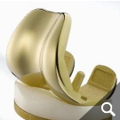 Beschichtete Knietotalendoprothese